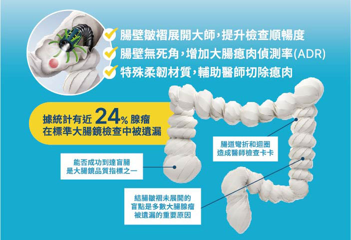 Endocuff 大腸鏡先端套頭