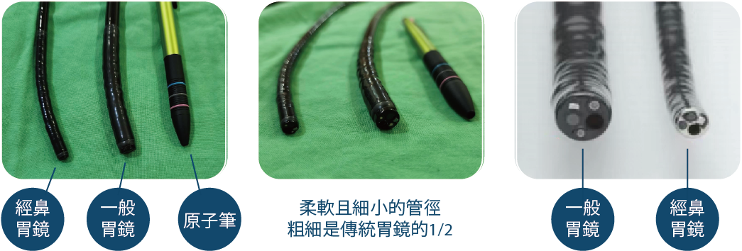 經鼻胃鏡 vs 一般胃鏡