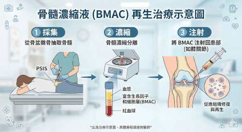 超越修復，開啟組織重生的「細胞種子」—— 骨髓濃縮液療法 (BMAC)