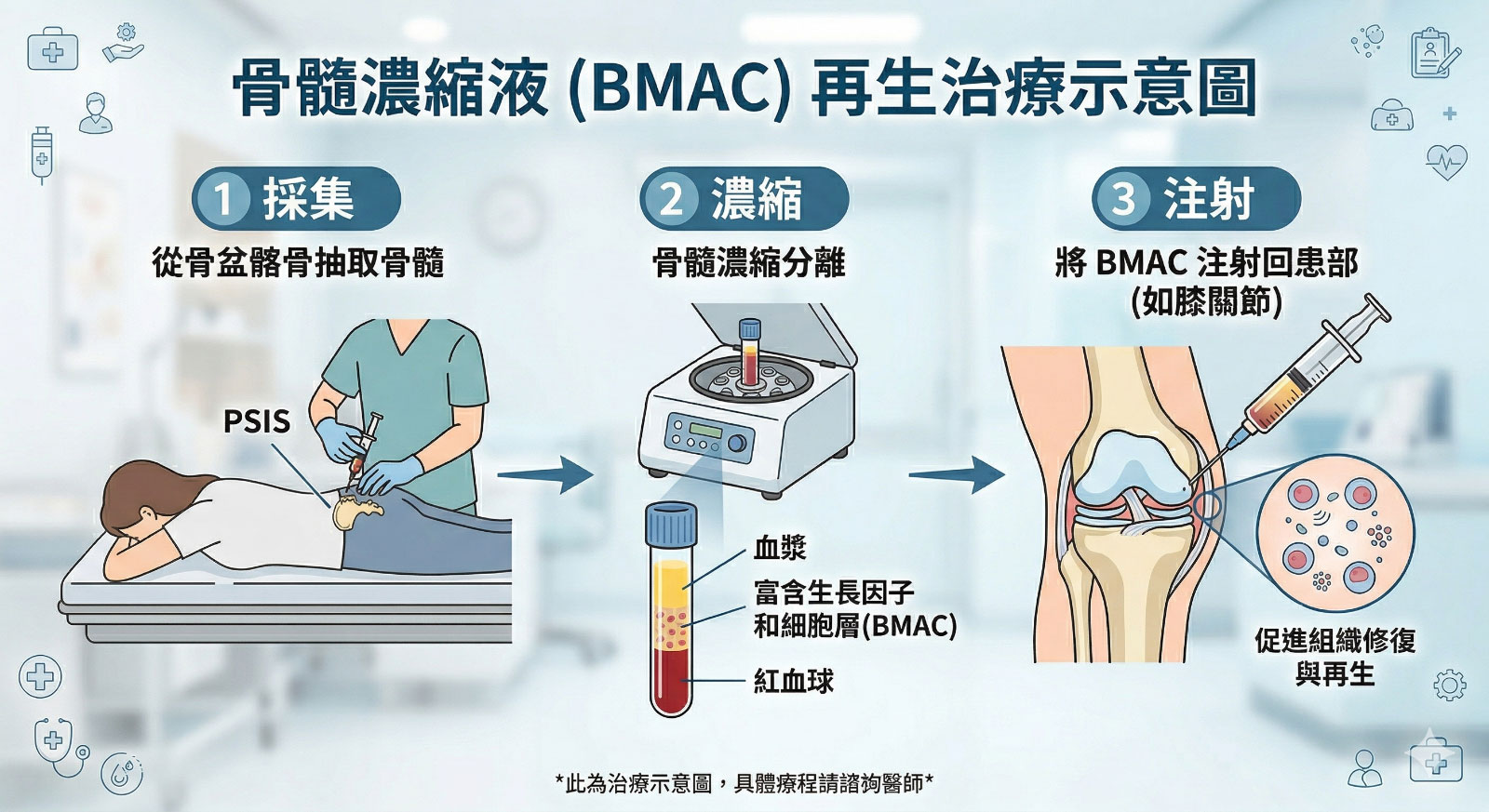 超越修復，開啟組織重生的「細胞種子」—— 骨髓濃縮液療法 (BMAC)